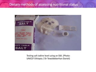 Nutritional assessment
