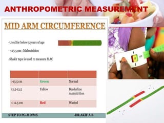 ANTHROPOMETRIC MEASUREMENT
 
