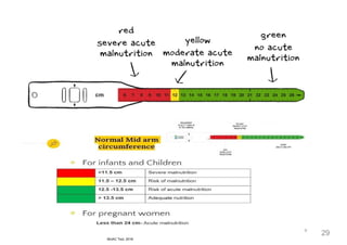 MUAC MEASURING TOOL
29
MUAC Tool, 2018
 