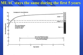 MUAC stays the same during the first 5 years
 