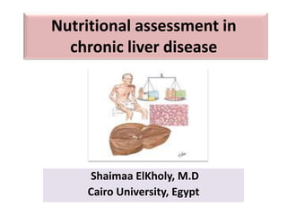 Nutritional assessment in
chronic liver disease
Shaimaa ElKholy, M.D
Cairo University, Egypt
Shaimaa Elkholy, M.D. Cairo University
 