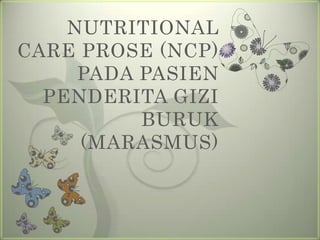 NUTRITIONAL
CARE PROSE (NCP)
PADA PASIEN
PENDERITA GIZI
BURUK
(MARASMUS)
 
