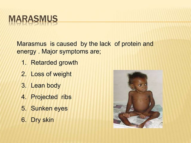 nutritional-deficiencies-power-point-presentation