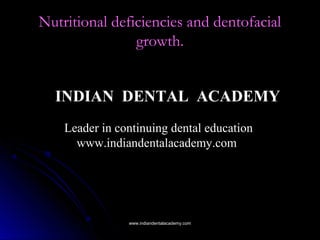 Nutritional deficiencies and dentofacial
growth.
INDIAN DENTAL ACADEMY
Leader in continuing dental education
www.indiandentalacademy.com

www.indiandentalacademy.com

 