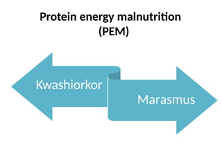 Protein energy malnutrition
(PEM)
Kwashiorkor
Marasmus
 