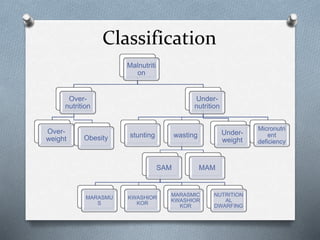 Classification
Malnutriti
on
Over-
nutrition
Over-
weight Obesity
Under-
nutrition
stunting wasting
SAM
MARASMU
S
KWASHIOR
KOR
MARASMIC
KWASHIOR
KOR
NUTRITION
AL
DWARFING
MAM
Under-
weight
Micronutri
ent
deficiency
 