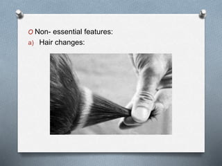 O Non- essential features:
a) Hair changes:
 