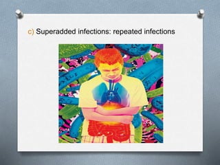 c) Superadded infections: repeated infections
 