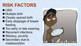 RISK FACTORS
 LBW
 Multiple birth
 Closely spaced birth
 Early stoppage of breast
feeding
 Too early or late weaning
 Recurrent infections
 Illiteracy, poverty
 Secondary due to
malabsorption
 