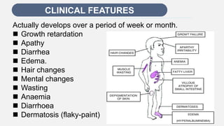 Enter title
CLINICAL FEATURES
Actually develops over a period of week or month.
 Growth retardation
 Apathy
 Diarrhea
 Edema.
 Hair changes
 Mental changes
 Wasting
 Anaemia
 Diarrhoea
 Dermatosis (flaky-paint)
 