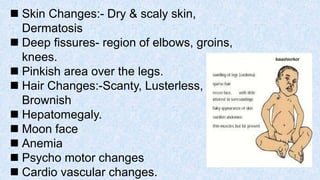  Skin Changes:- Dry & scaly skin,
Dermatosis
 Deep fissures- region of elbows, groins,
knees.
 Pinkish area over the legs.
 Hair Changes:-Scanty, Lusterless,
Brownish
 Hepatomegaly.
 Moon face
 Anemia
 Psycho motor changes
 Cardio vascular changes.
 