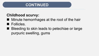Enter title
CONTINUED
Childhood scurvy:
 Minute hemorrhages at the root of the hair
 Follicles.
 Bleeding to skin leads to petechiae or large
purpuric swelling, gums
 