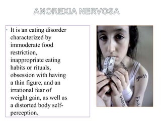 • It is an eating disorder
characterized by
immoderate food
restriction,
inappropriate eating
habits or rituals,
obsession with having
a thin figure, and an
irrational fear of
weight gain, as well as
a distorted body self-
perception.
 
