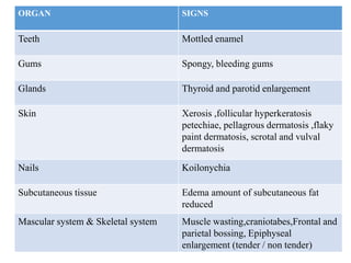 ORGAN SIGNS
Teeth Mottled enamel
Gums Spongy, bleeding gums
Glands Thyroid and parotid enlargement
Skin Xerosis ,follicular hyperkeratosis
petechiae, pellagrous dermatosis ,flaky
paint dermatosis, scrotal and vulval
dermatosis
Nails Koilonychia
Subcutaneous tissue Edema amount of subcutaneous fat
reduced
Mascular system & Skeletal system Muscle wasting,craniotabes,Frontal and
parietal bossing, Epiphyseal
enlargement (tender / non tender)
 