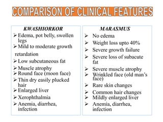 KWASHIORKOR
Edema, pot belly, swollen
legs
Mild to moderate growth
retardation
Low subcutaneous fat
Muscle atrophy
Round face (moon face)
Thin dry easily plucked
hair
Enlarged liver
Xerophthalmia
Anemia, diarrhea,
infection
MARASMUS
 No edema
 Weight loss upto 40%
 Severe growth failure
 Severe loss of subacute
fat
 Severe muscle atrophy
 Wrinkled face (old man’s
face)
 Rare skin changes
 Common hair changes
 Mildly enlarged liver
 Anemia, diarrhea,
infection
 