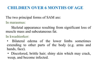 CHILDREN OVER 6 MONTHS OF AGE
The two principal forms of SAM are:
In marasmus:
Skeletal appearance resulting from significant loss of
muscle mass and subcutaneous fat.
In kwashiorkor:
• Bilateral edema of the lower limbs sometimes
extending to other parts of the body (e.g. arms and
hands, face).
• Discolored, brittle hair; shiny skin which may crack,
weep, and become infected.
 