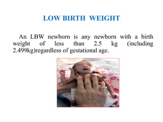 LOW BIRTH WEIGHT
An LBW newborn is any newborn with a birth
weight of less than 2.5 kg (including
2.499kg)regardless of gestational age.
 