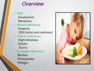 Overview
• PEM
Kwashiorkar
Marasmus
• Mineral deficiency
Anaemia
IDD( Goiter and cretinism)
• Vitamin deficiency
Night blindness
Rickets
Scurvy
• B complex deficiency
Beriberi
Photophobia
Pellagra
 