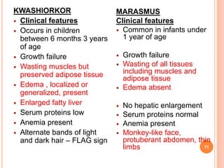 KWASHIORKOR
 Clinical features
 Occurs in children
between 6 months 3 years
of age
 Growth failure
 Wasting muscles but
preserved adipose tissue
 Edema , localized or
generalized, present
 Enlarged fatty liver
 Serum proteins low
 Anemia present
 Alternate bands of light
and dark hair – FLAG sign
MARASMUS
Clinical features
 Common in infants under
1 year of age
 Growth failure
 Wasting of all tissues
including muscles and
adipose tissue
 Edema absent
 No hepatic enlargement
 Serum proteins normal
 Anemia present
 Monkey-like face,
protuberant abdomen, thin
limbs 11
 