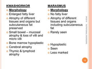 KWASHIORKOR
 Morphology
 Enlarged fatty liver
 Atrophy of different
tissues and organs but
subcutaneous fat
preserved
 Small bowel – mucosal
atrophy & loss of villi and
micro villi
 Bone marrow hypoplastic
 Cerebral atrophy
 Thymic & lymphoid
atrophy
MARASMUS
 Morphology
 No fatty liver
 Atrophy of different
tissues and organs
including subcutaneous
fat
 Rarely seen
 Hypoplastic
 Seen
 Less marked
3/8/2019
12
NUTRITIONALDISORDERS
 