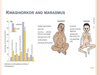 KWASHIORKOR AND MARASMUS
3/8/201913
NUT
RITI
ONA
L
DIS
ORD
ERS
 