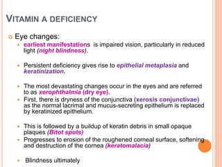 VITAMIN A DEFICIENCY
 Eye changes:
 earliest manifestations is impaired vision, particularly in reduced
light (night blindness).
 Persistent deficiency gives rise to epithelial metaplasia and
keratinization.
 The most devastating changes occur in the eyes and are referred
to as xerophthalmia (dry eye).
 First, there is dryness of the conjunctiva (xerosis conjunctivae)
as the normal lacrimal and mucus-secreting epithelium is replaced
by keratinized epithelium.
 This is followed by a buildup of keratin debris in small opaque
plaques (Bitot spots)
 Progresses to erosion of the roughened corneal surface, softening
and destruction of the cornea (keratomalacia)
 Blindness ultimately
 