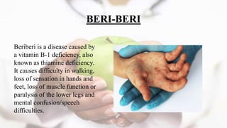 Be Ri NUTRITIONAL DISORDERS AND PROTEIN ENERGY MALNUTRITION | PPTX