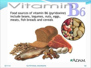 02/11/14

NUTRITIONAL DISORDERS

102

 