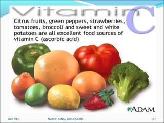 02/11/14

NUTRITIONAL DISORDERS

107

 