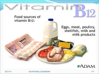 02/11/14

NUTRITIONAL DISORDERS

117

 