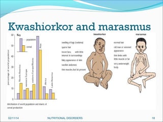 02/11/14

NUTRITIONAL DISORDERS

18

 