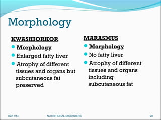 Morphology
KWASHIORKOR
Morphology
Enlarged fatty liver
Atrophy of different
tissues and organs but
subcutaneous fat
preserved

02/11/14

NUTRITIONAL DISORDERS

MARASMUS
Morphology
No fatty liver
Atrophy of different
tissues and organs
including
subcutaneous fat

20

 