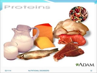 02/11/14

NUTRITIONAL DISORDERS

32

 