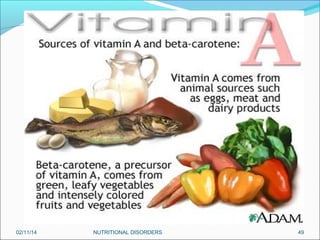 02/11/14

NUTRITIONAL DISORDERS

49

 