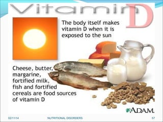 02/11/14

NUTRITIONAL DISORDERS

57

 