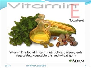 02/11/14

NUTRITIONAL DISORDERS

72

 