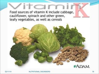 02/11/14

NUTRITIONAL DISORDERS

78

 