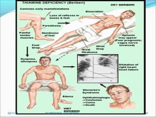 02/11/14

NUTRITIONAL DISORDERS

87

 