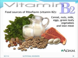 02/11/14

NUTRITIONAL DISORDERS

90

 