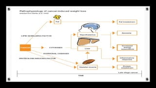 Nutritional managment of cachexia | PPT