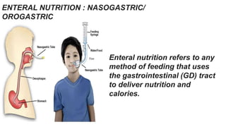 ENTERAL NUTRITION : NASOGASTRIC/
OROGASTRIC
Enteral nutrition refers to any
method of feeding that uses
the gastrointestinal (GD) tract
to deliver nutrition and
calories.
 