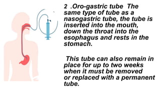 2 .Oro-gastric tube The
same type of tube as a
nasogastric tube, the tube is
inserted into the mouth,
down the throat into the
esophagus and rests in the
stomach.
This tube can also remain in
place for up to two weeks
when it must be removed
or replaced with a permanent
tube.​​
 