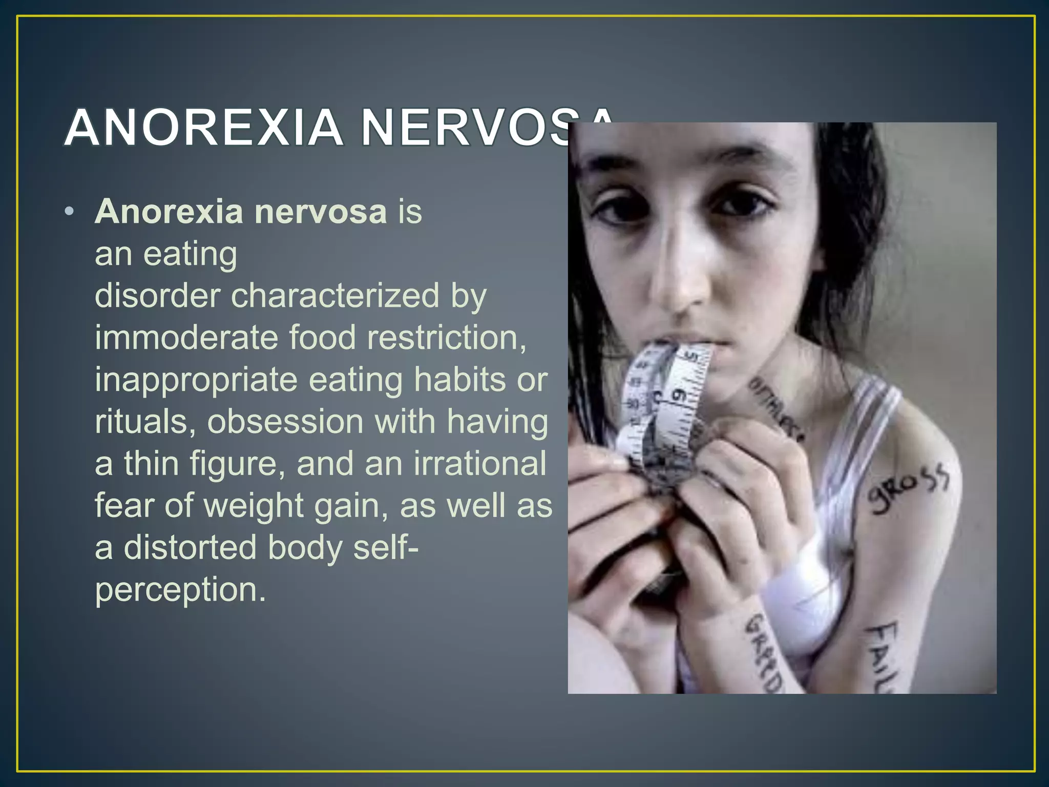 • Anorexia nervosa is
an eating
disorder characterized by
immoderate food restriction,
inappropriate eating habits or
rituals, obsession with having
a thin figure, and an irrational
fear of weight gain, as well as
a distorted body self-
perception.
 