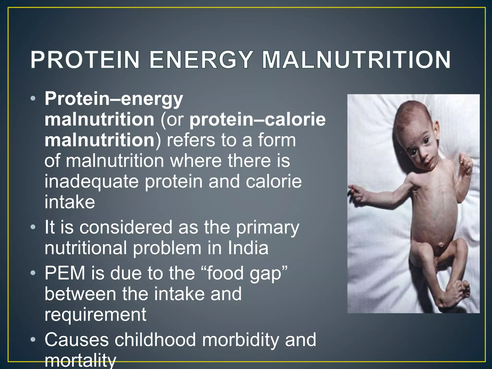 • Protein–energy
malnutrition (or protein–calorie
malnutrition) refers to a form
of malnutrition where there is
inadequate protein and calorie
intake
• It is considered as the primary
nutritional problem in India
• PEM is due to the “food gap”
between the intake and
requirement
• Causes childhood morbidity and
mortality
 