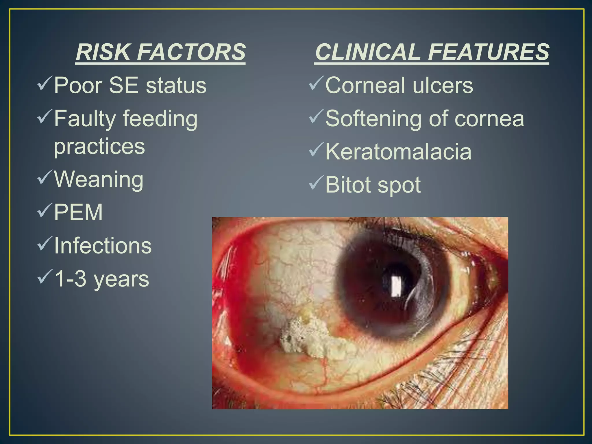 RISK FACTORS
Poor SE status
Faulty feeding
practices
Weaning
PEM
Infections
1-3 years
CLINICAL FEATURES
Corneal ulcers
Softening of cornea
Keratomalacia
Bitot spot
 