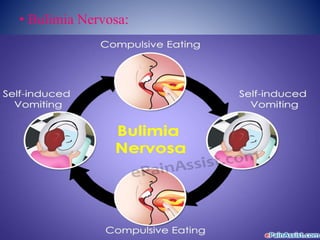 • Bulimia Nervosa:
 