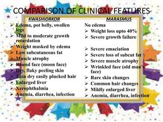 COMPARISON OF CLINICAL FEATURES
KWASHIORKOR
 Edema, pot belly, swollen
legs
 Mild to moderate growth
retardation
 Weight masked by edema
 Low subcutaneous fat
 Muscle atrophy
 Round face (moon face)
 Dry, flaky peeling skin
 Thin dry easily plucked hair
 Enlarged liver
 Xerophthalmia
 Anemia, diarrhea, infection
MARASMUS
No edema
 Weight loss upto 40%
 Severe growth failure
 Severe emaciation
 Severe loss of subcut fat
 Severe muscle atrophy
 Wrinkled face (old man’s
face)
 Rare skin changes
 Common hair changes
 Mildly enlarged liver
 Anemia, diarrhea, infection
 