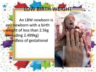LOW BIRTH WEIGHT
An LBW newborn is
any newborn with a birth
weight of less than 2.5kg
(including 2.499kg)
regardless of gestational
age.
 