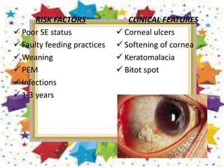 RISK FACTORS
 Poor SE status
 Faulty feeding practices
 Weaning
 PEM
 Infections
 1-3 years
CLINICAL FEATURES
 Corneal ulcers
 Softening of cornea
 Keratomalacia
 Bitot spot
 