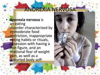 ANOREXIA NERVOSA
• Anorexia nervosa is
an eating
disorder characterized by
immoderate food
restriction, inappropriate
eating habits or rituals,
obsession with having a
thin figure, and an
irrational fear of weight
gain, as well as a
distorted body self-
perception.
 